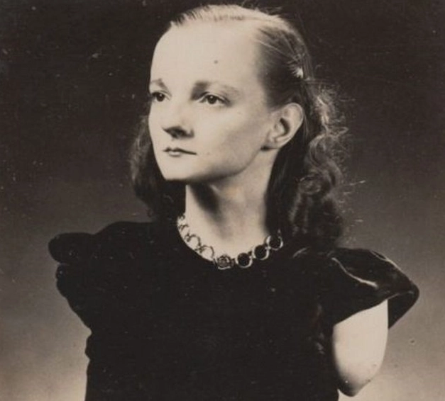 How Did They Do It? 10 Jaw-Dropping Feats by Limbless Icons -- #5 Is Mind-Blowing