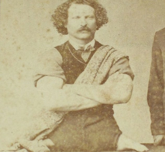 How Did They Do It? 10 Jaw-Dropping Feats by Limbless Icons -- #5 Is Mind-Blowing